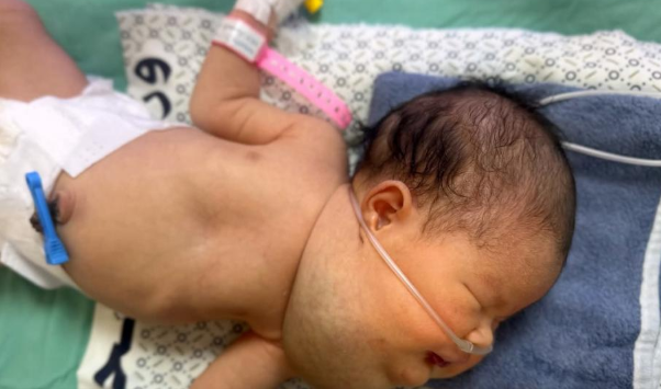 الرضيعة حور قشطة… جسد صغير يصارع مرضًا نادرًا في منظومة صحية منهكة  