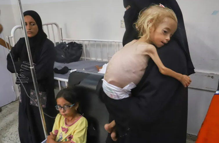 وفاة شابة من غزة جوعا بعدما وصلت إلى مستشفى في إيطاليا