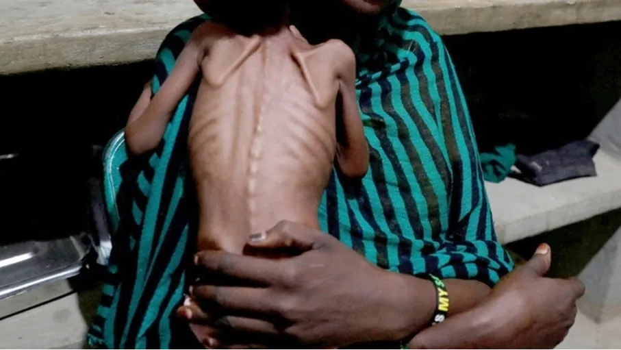  21 مليون سوداني يواجهون الجوع الحاد 