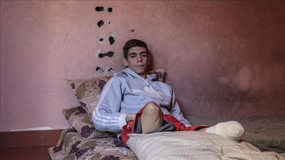 بين الرُّكام والمُخلفات ..  قصة داود الذي بترت الحرب ساقيه ومستقبله 