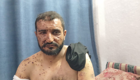 فؤاد أبو الحسنى ..  القصفُ حفر خريطة للألم على وجهه وجسده 