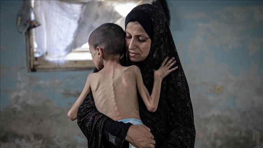"الأونروا": 1.6 مليون فلسطيني يعانون سوء التغذية في غزة 