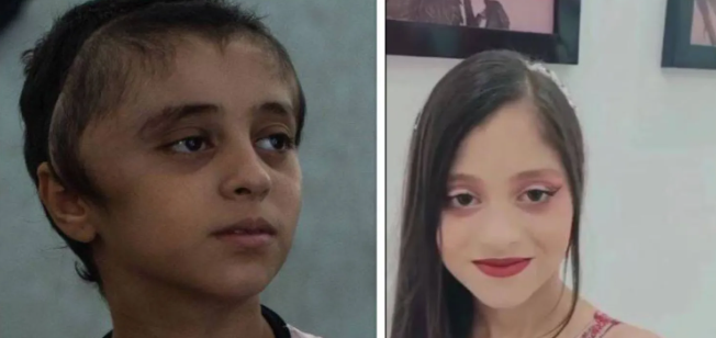 مريم إبراهيم ..  طفلة غزّية فقدت جزءاً من جمجمتها تبحث عن علاج خارج القطاع