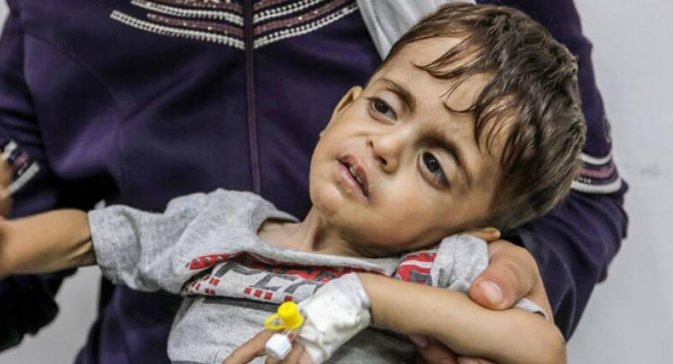 تدمير المشافي في غزة يحرم 11 ألف مريض سرطان من العلاج