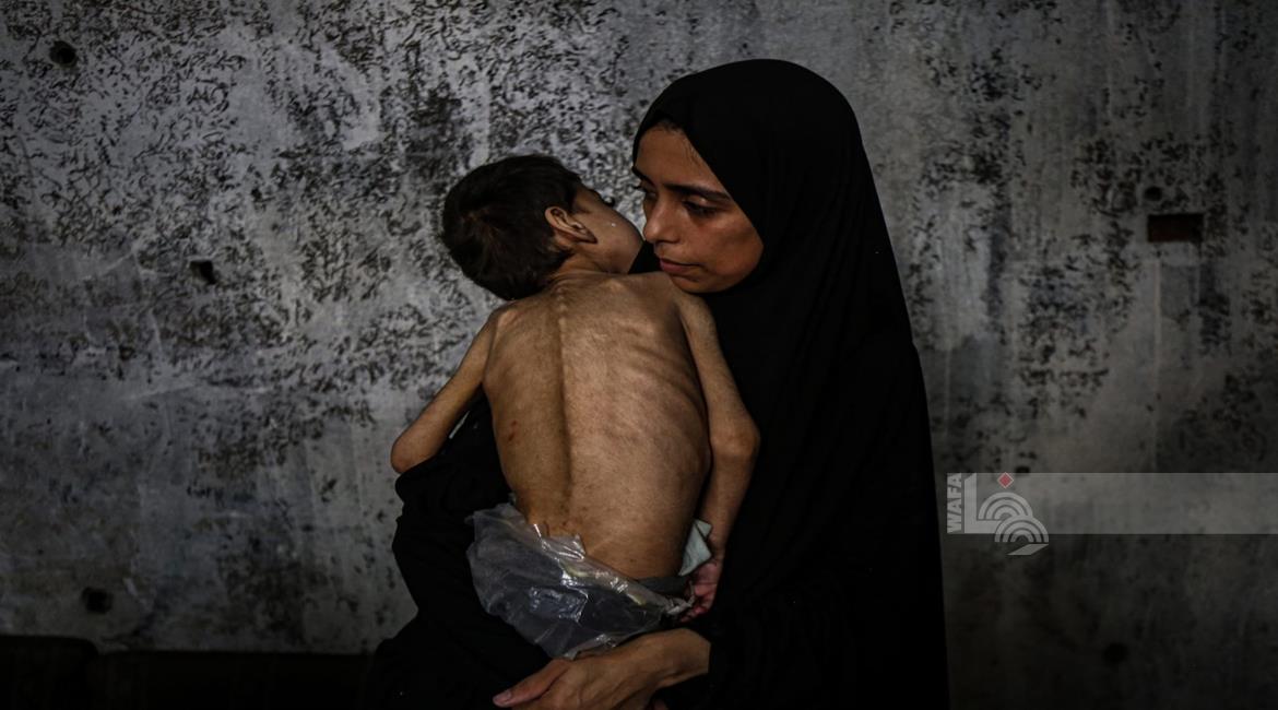 التجويع مُستمر  ..  4 وفيات خلال 24 ساعة في غزة 