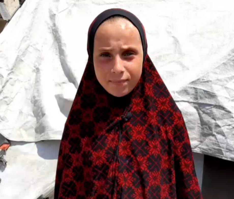 الطِّفلة أنسام زيد ..  صراع مع مرض السَّرطان والحرب 