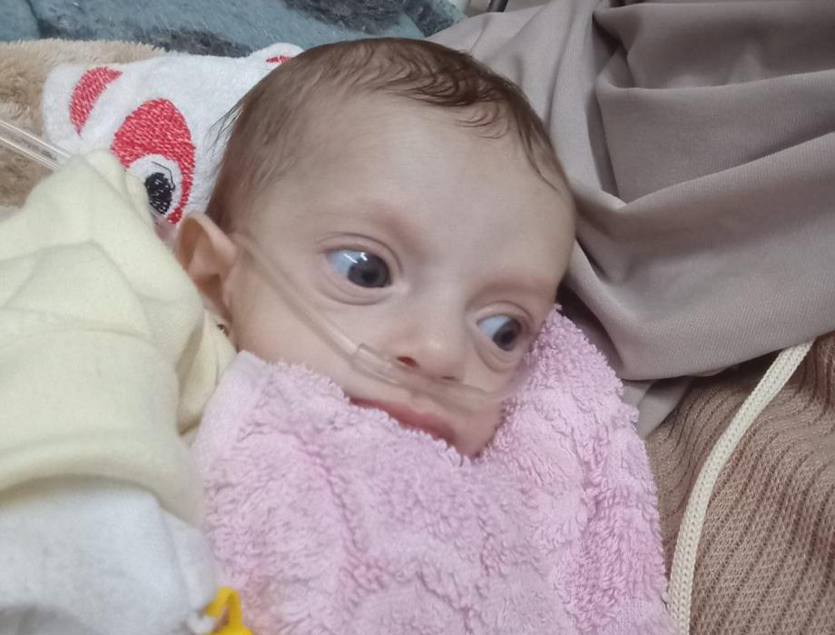ألما أبو ريدة… رضيعة غزة تصارع أنفاسها من أجل الحياة