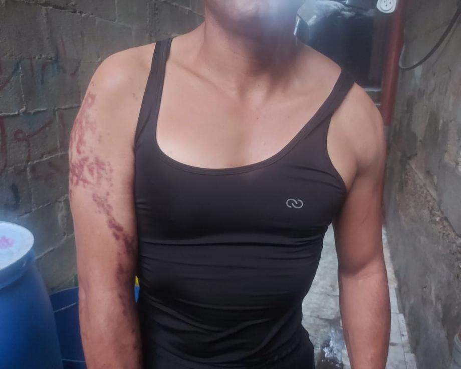 الجريح حمتو ..  من مدرب كمال أجسام إلى جريح يئن ألمًا 