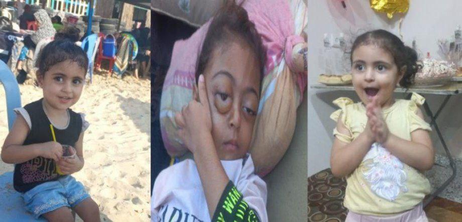 ريتال ..  حكاية طفلة تُصارع السرطان في غزة  