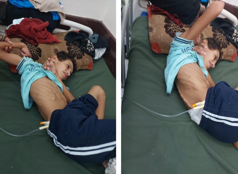 شظية أغلقت باب الطفولة… يوسف ينتظر الحياة من سرير العجز  