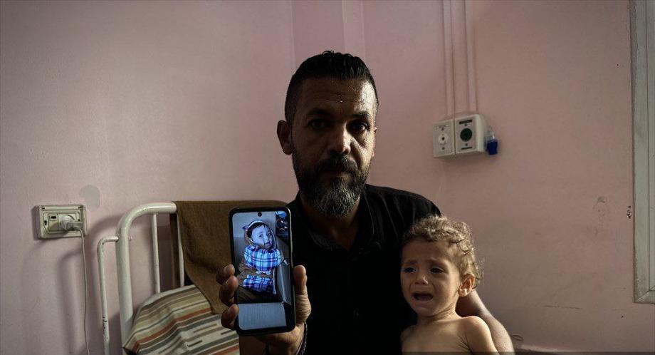 هزار عرفة ..  طفلة تنهشها المجاعة وتصارع الموت في غزة  