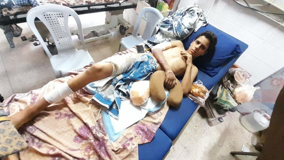  الجريح "البهتيني" ..  فتى مزَّقت جسده قنبلة "كواد كابتر"  