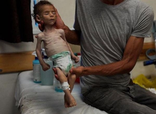 "العفو الدولية": غزة تواجه مجاعة جماعية ولا بد من وقف إطلاق نار دائم  