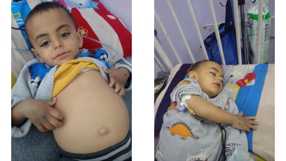 طفولة معلّقة بين المرض والنزوح… نضال أبو ربيع يقاوم وجع الحصار  