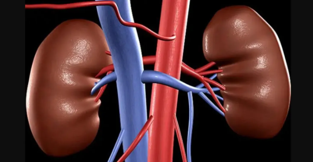 5 علاجات طبيعية يمكنك اتباعها للتخلص من حصوات الكلى