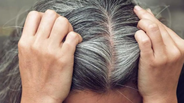 بدون صبغات  ..  السر الطبيعي الأقوى لإخفاء الشعر الأبيض! 