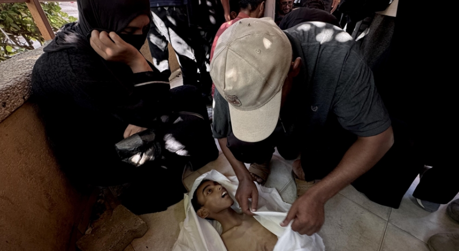 صحة غزة تعلن تسجل 45 حالة "شلل رخو حاد" خلال شهرين