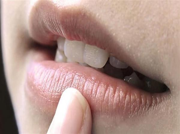 تصبغ الشفاه  ..  عادات يومية وأسباب تسرق لونها الطبيعي 
