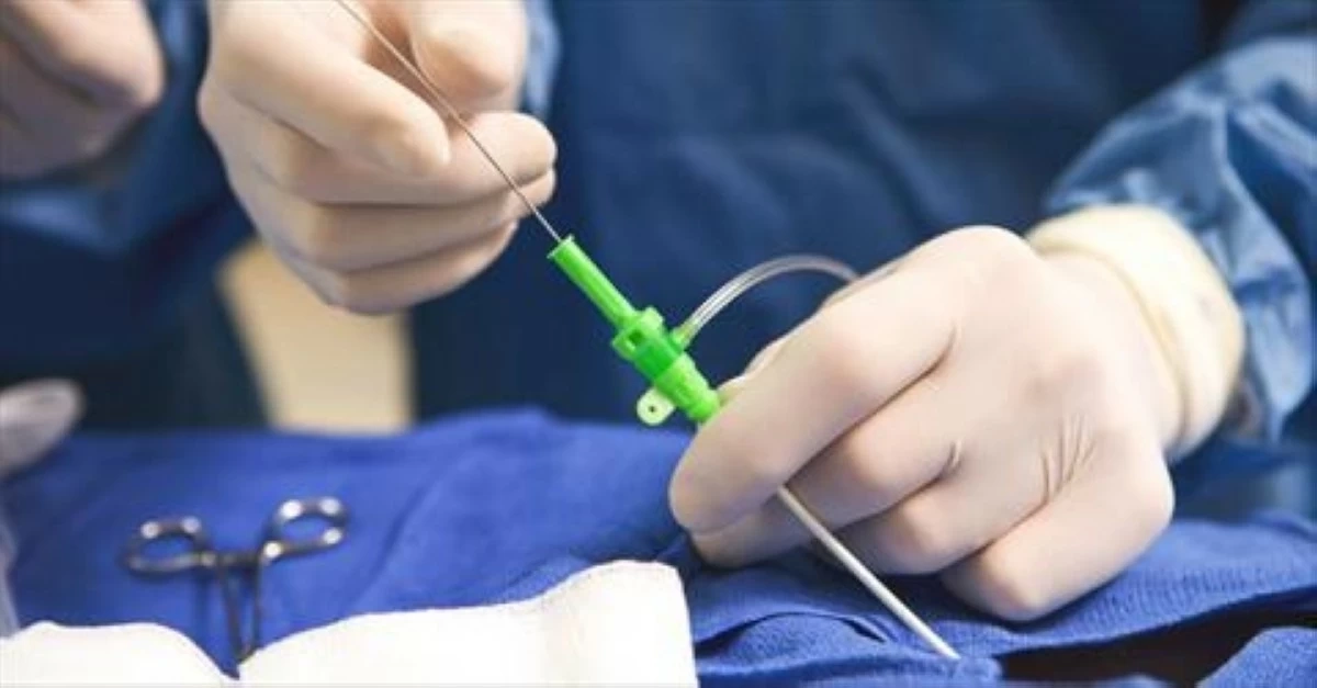 خدمات القسطرة ..  ضرورة عاجلة للمحافظات