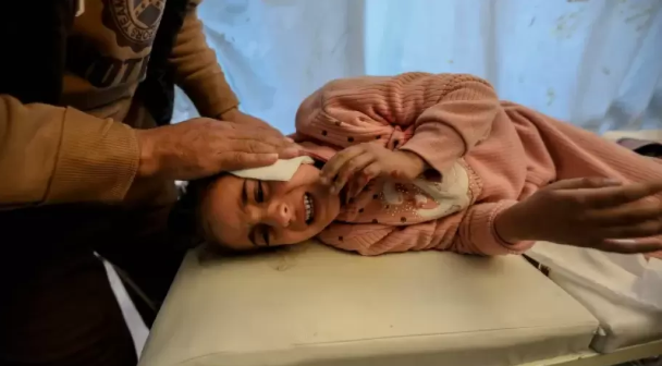 "أنا موجوعة يا ماما" ..  منال التي سرقت الحرب طفولتها 