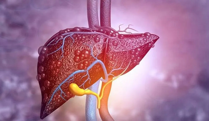 الأردن "ملتزم" بالقضاء على التهاب الكبد بحلول 2030