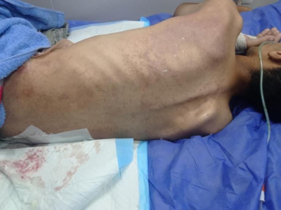 نبيل أبو جبر ..  من مصائد الموت إلى انتكاسات الإصابة في غزة 