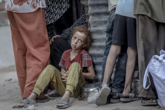 وفاة طفلين من سكان جنوب قطاع غزة جوعا