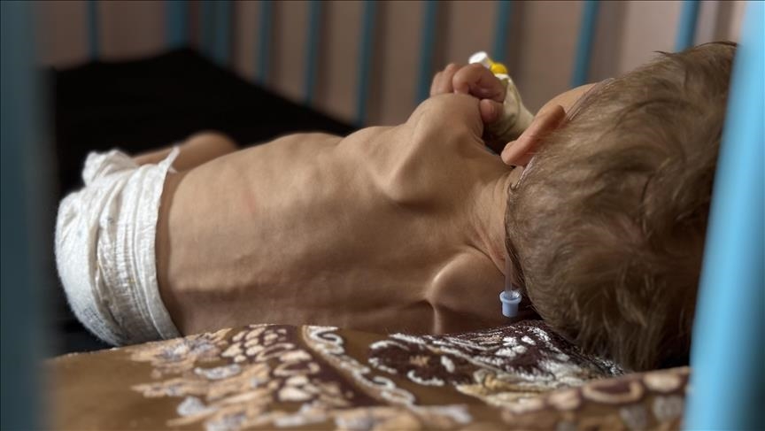 اليونيسف: طفل من كل 5 بغزَّة يعاني من نقص بالوزن عند الولادة 