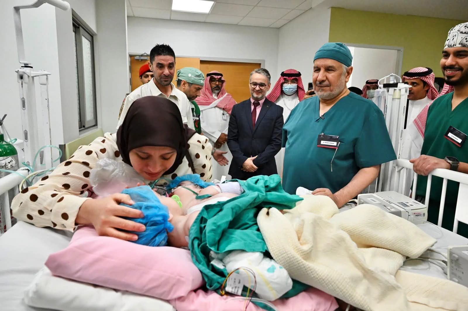 بدء عملية فصل التوأم الملتصق "سجى وضحى" بالرياض