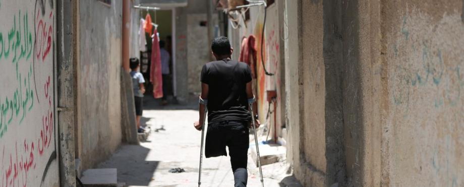 قدمه التي "تطعمه" بُترت ..  الجريح "خالد" "سجين كرسي مهترئ" 