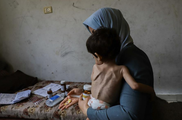 أبو سلمية: المجاعة في غزة دخلت مرحلة خطيرة وقد نفقد الجرحى