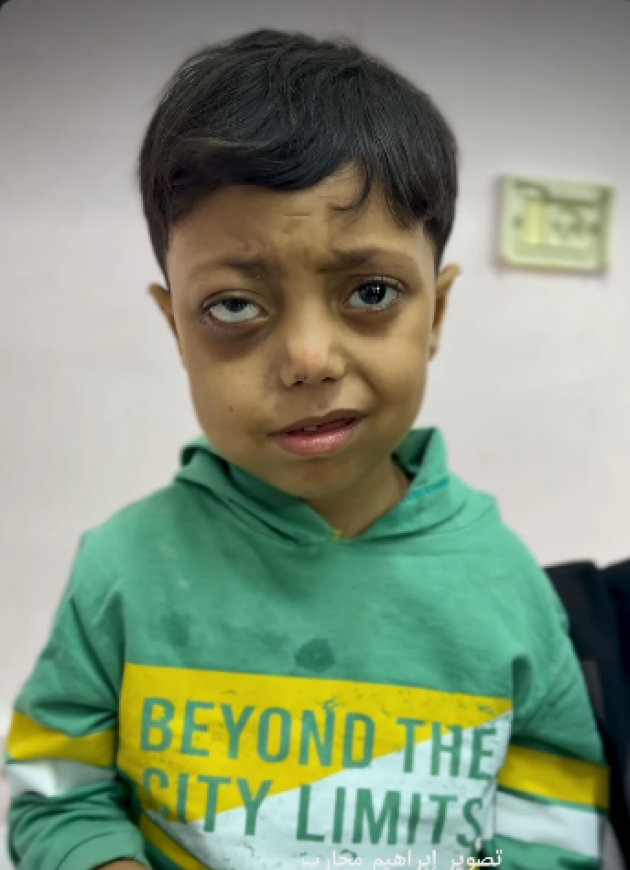 "بدي أعيش زيُّ باقي الأطفال" ..  صرخة خالد قبل أن يطفئ الورم الخبيث طفولته  