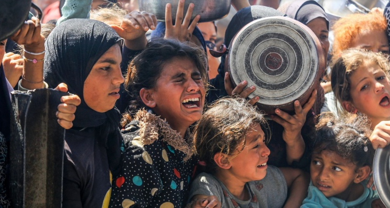 70 ألف طفل بغزة يواجهون مستويات حادة من سوء التغذية