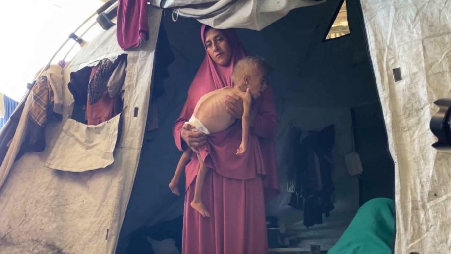 2025 ..  العام الأشدُّ مجاعةً في غزَّة  