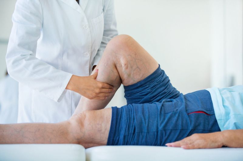 الجلطة الوريدية العميقة ..  الأسباب والأعراض والعلاج