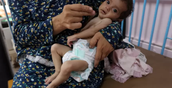 "غيلان باريه" ..  مرض نادر يفتك بأطفال غزة وسط نقص حاد في العلاج 