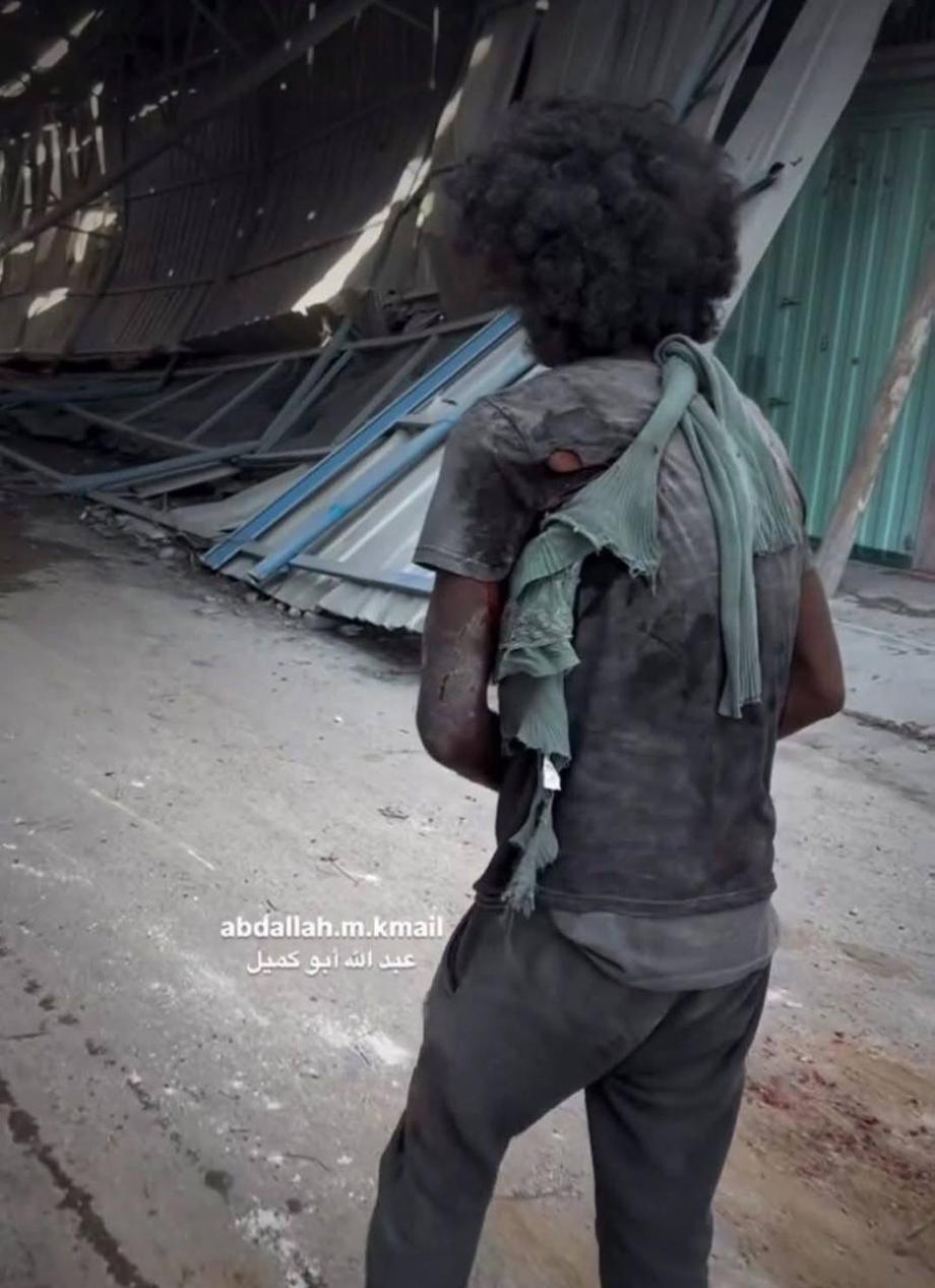 أحمد الهواري ..  ناجٍ يروي تفاصيل 23 يومًا تحت الركام في حي الزيتون  