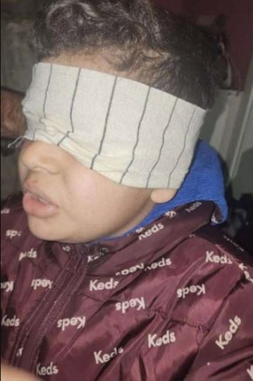 أحمد ..  طفل بعينين معصوبتين وذاكرة مثقلة بالخوف