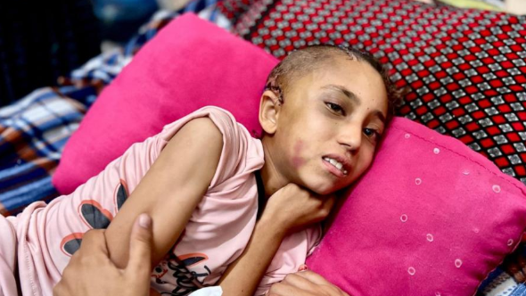جراحها خطيرة لا تندمل ..  "مَيْس" تموت بصمت 