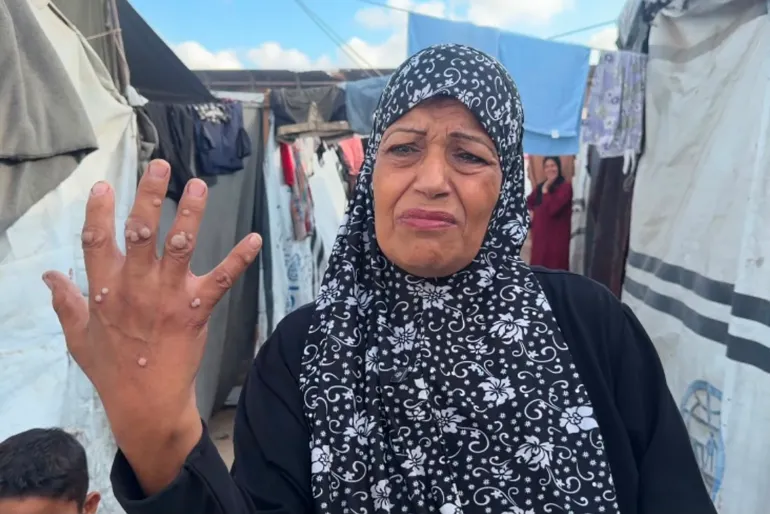 القوارض تفتح جبهة جديدة على الغزيين