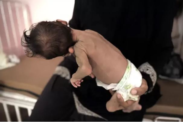 البرش: الأطفال يموتون بالجملة في غزة
