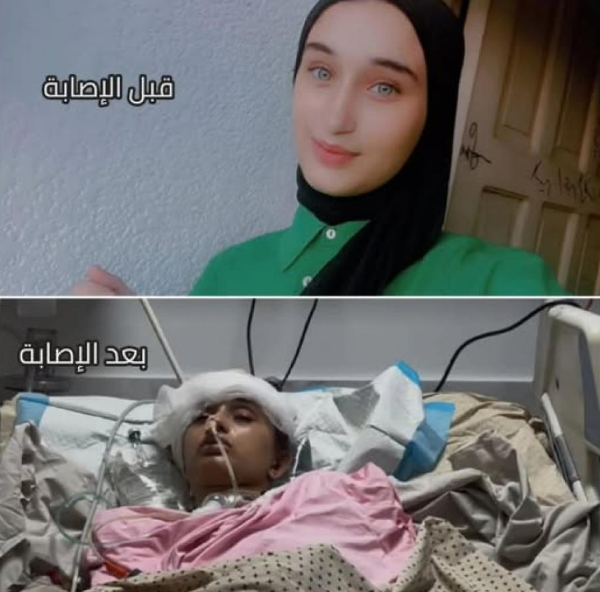 كانت تحلم بدراسة "التوجيهي" ..  "بتول" بين الحياة والغيبوبة 