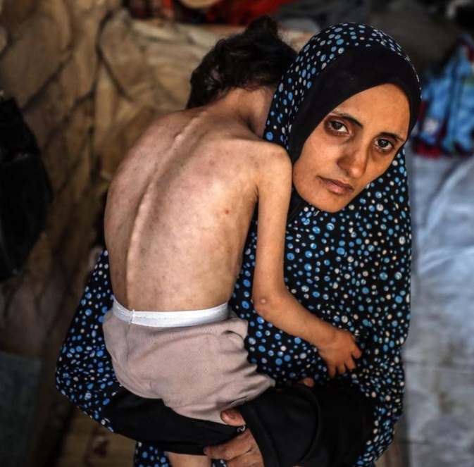 تسجيل برنامج المكملات الغذائية المجانية في غزة للأطفال والحوامل والمرضعات 