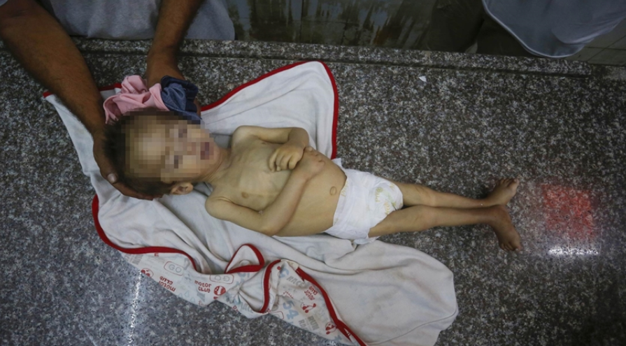 غزة ..  ارتفاع وفيات التجويع الإسرائيلي إلى 154 فلسطينيا بينهم 89 طفلا