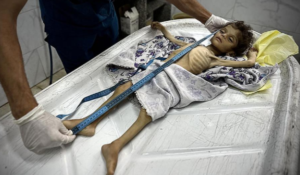 استشهاد 5 فلسطينين بينهم طفلان بسبب التجويع الإسرائيلي 