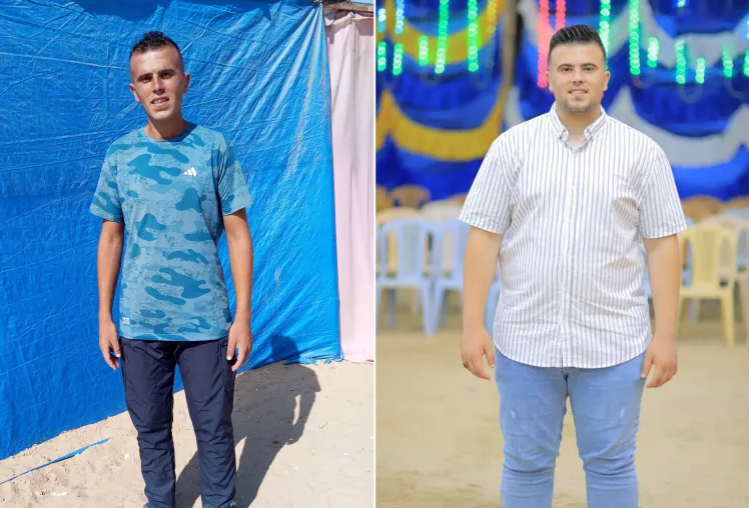 "ليست حمية ولا رياضة" ..  غزيون يوثقون أثر المجاعة على أجسادهم