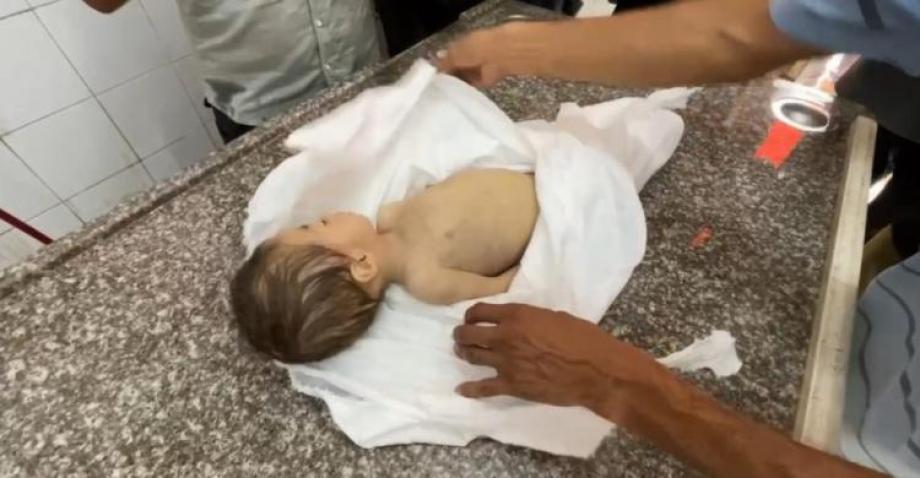 الطِّفلة مكَّة ..  ضحيَّة جديدة للمجاعة في غزَّة
