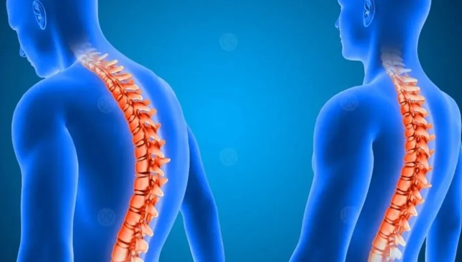 لأول مرة  ..  استئصال ورم في العمود الفقري عبر العين 