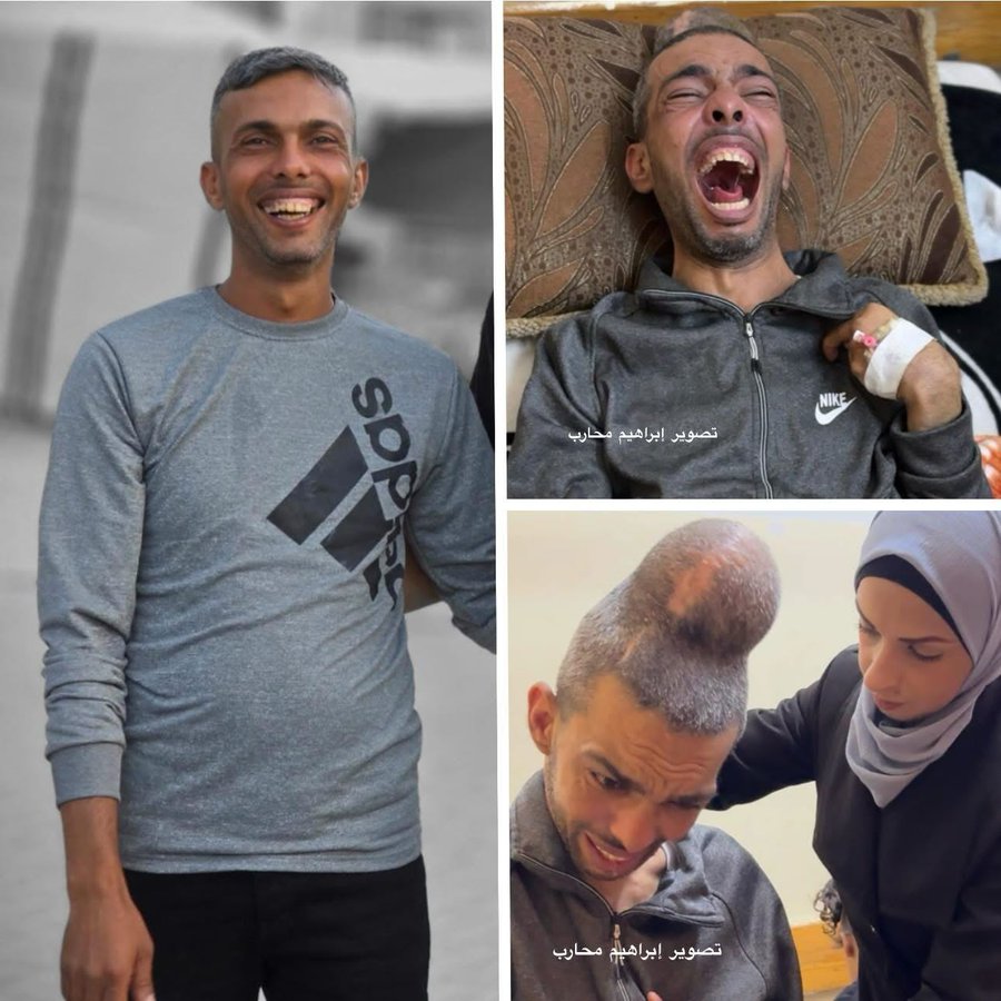 رائد المريدي يصارع الموت وزوجته تستغيث لإنقاذه خارج غزة  