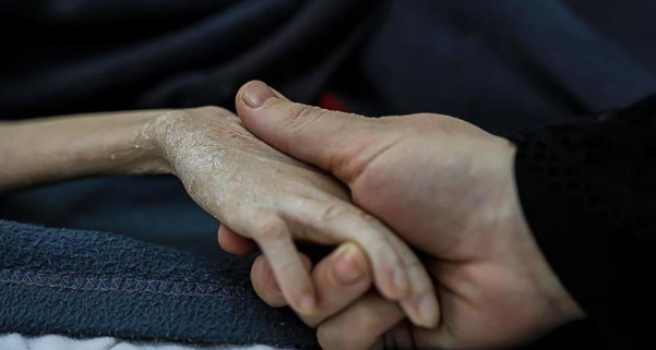3 حالات وفاة خلال الـ 24 ساعة الماضية بسبب المجاعة وسوء التَّغذية في غزة 